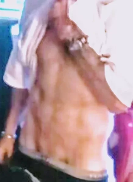 7foot2inchestall_amputee with the username @tall_fun_amputee is a German OnlyFans model.